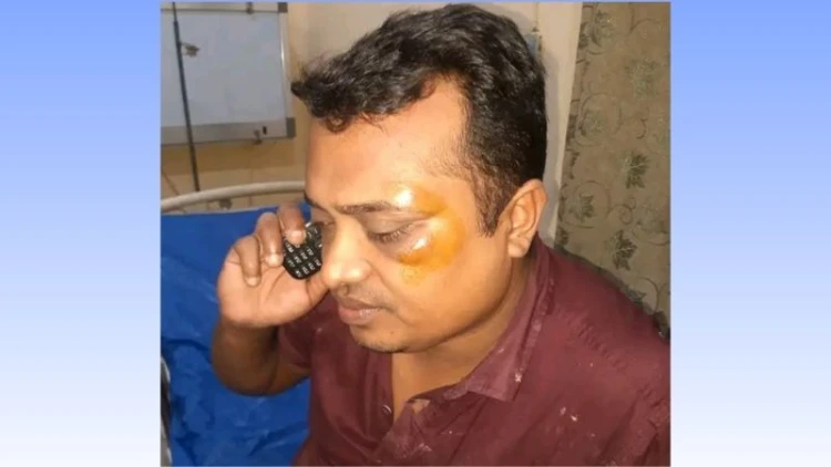 ফেনীতে সাংবাদিকের ওপর সন্ত্রাসী হামলা, গ্রেফতার ১